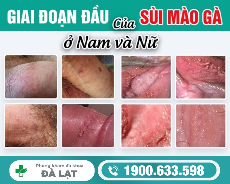 Hình ảnh minh họa